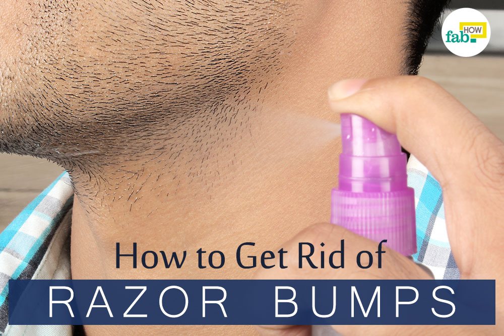 Can Ice get rid of razor bumps?