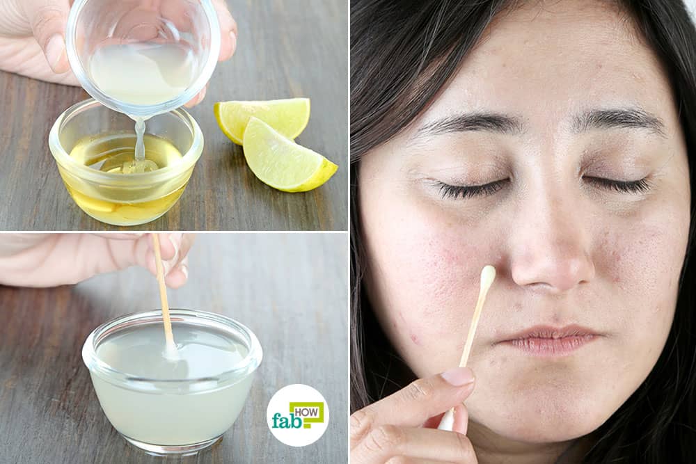 Can lemon remove dark spots?