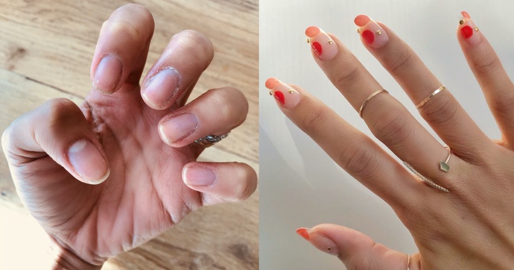 Can you get gel extensions on short nails?
