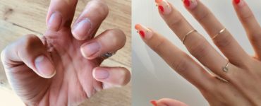Can you get gel extensions on short nails?