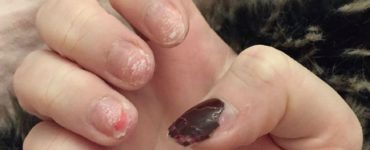 Do acrylics ruin your nails?