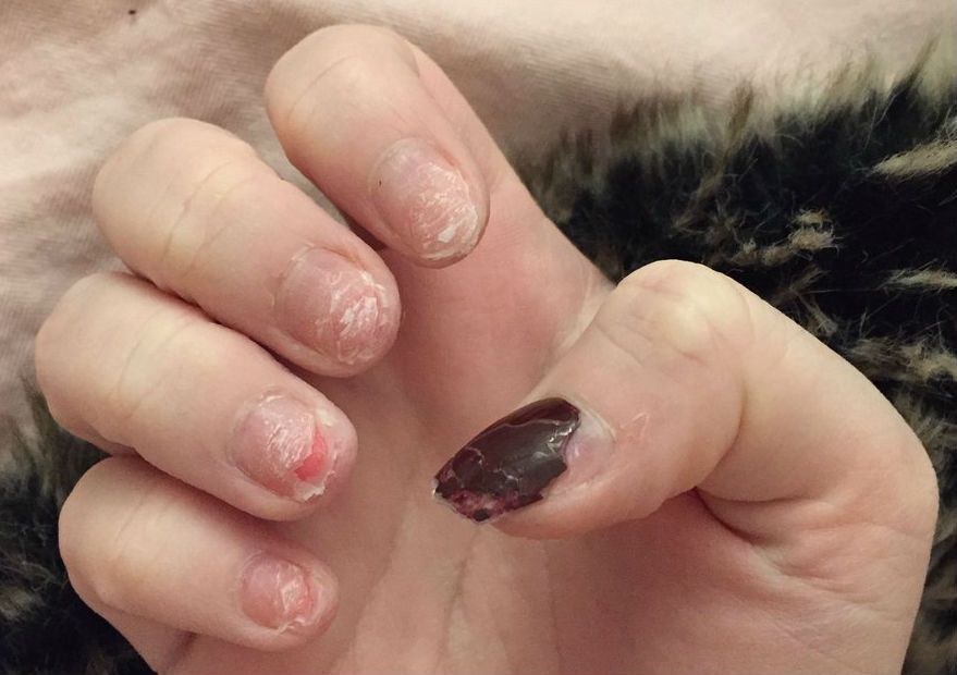 Do acrylics ruin your nails?