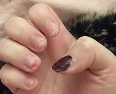 Do gel nails ruin your nails?