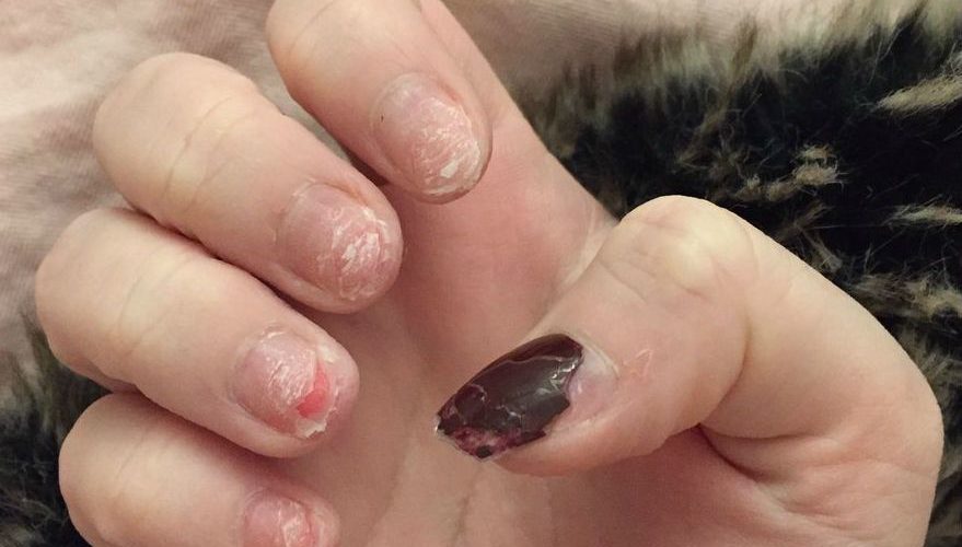 Do gel nails ruin your nails?