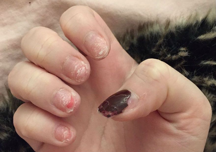 Do gel nails ruin your nails?