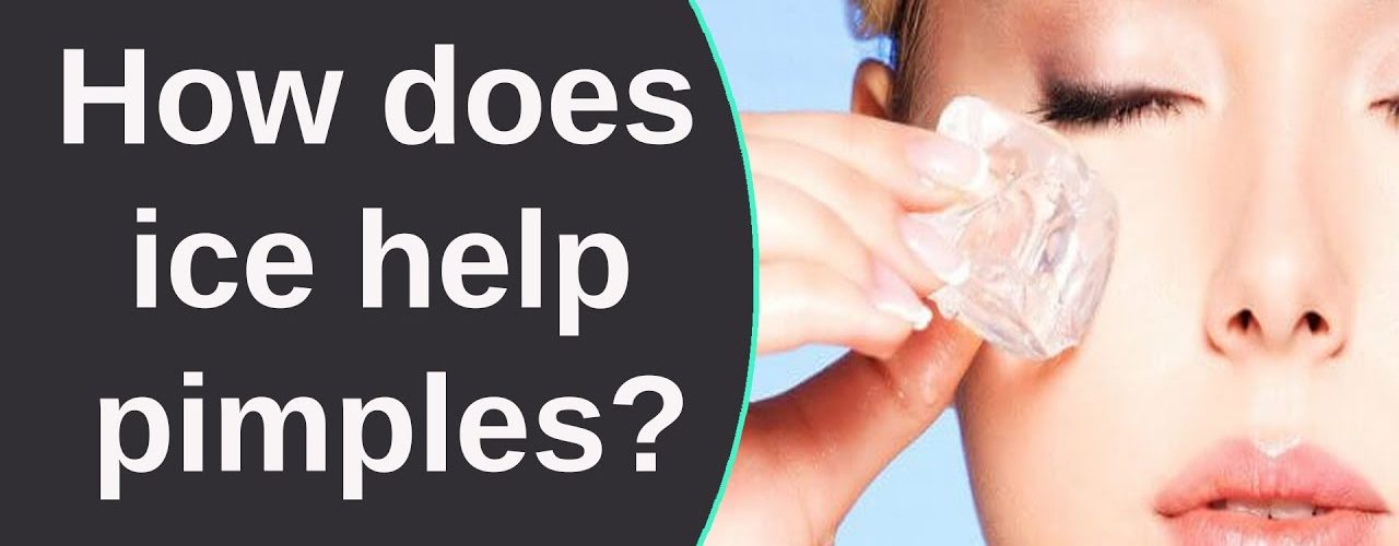 Does ice help blind pimples?
