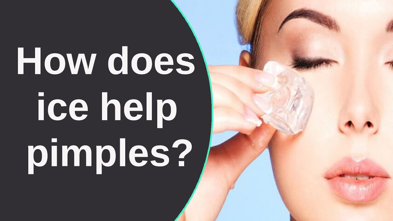 does-ice-help-blind-pimples