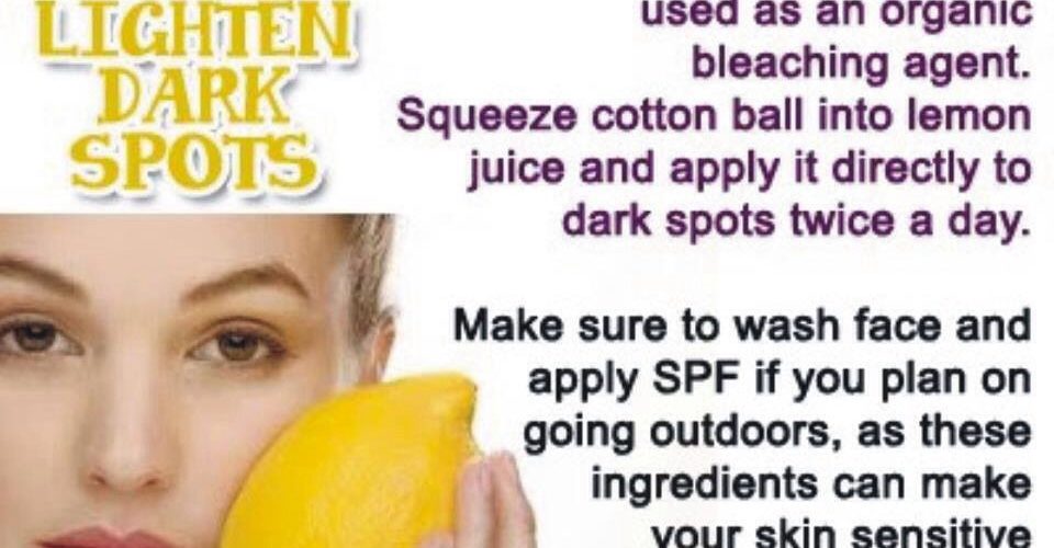 Does lemon help dark spots?