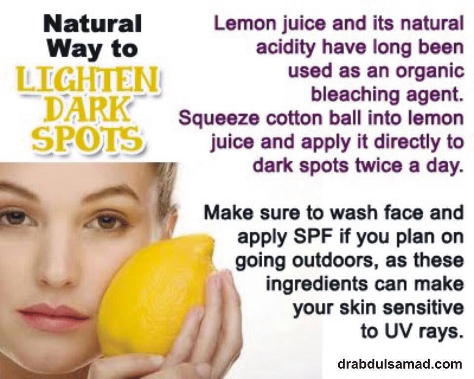 Does lemon help dark spots?