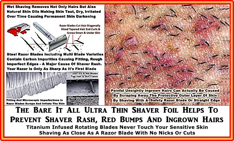 Does shaving cause ingrown hair?