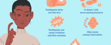 Does toothpaste work on pimples?