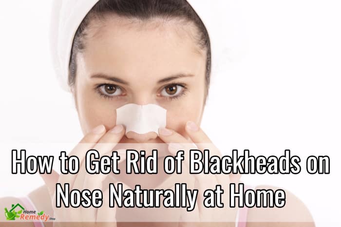 How do I permanently get rid of blackheads on my nose?