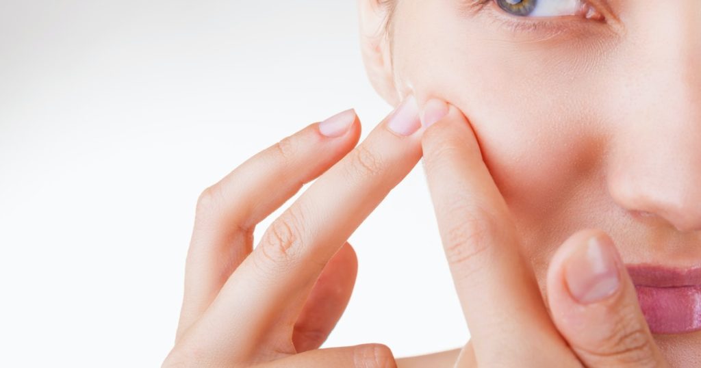 How do you flatten a pimple overnight?