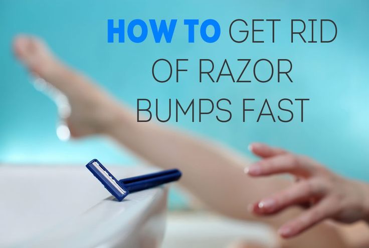 How do you get rid of bikini bumps fast?