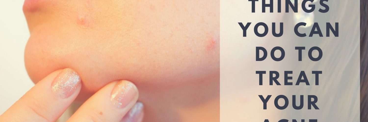 How do you treat kids acne?