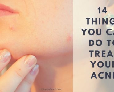 How do you treat kids acne?