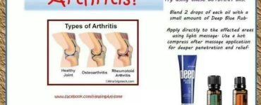 Is Deep Blue Rub good for arthritis?