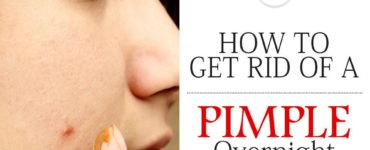 What can I put on a pimple overnight?
