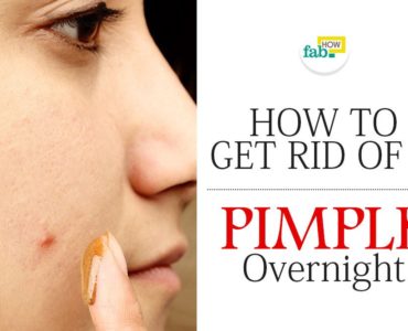 What can I put on a pimple overnight?
