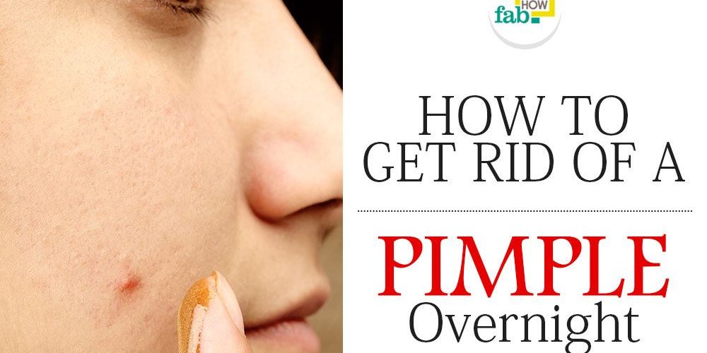What can I put on a pimple overnight?