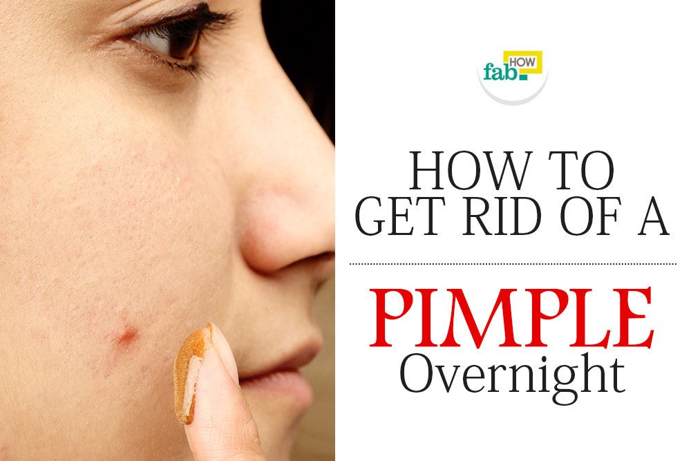 How To Get Rid Of Big Red Pimples Overnight