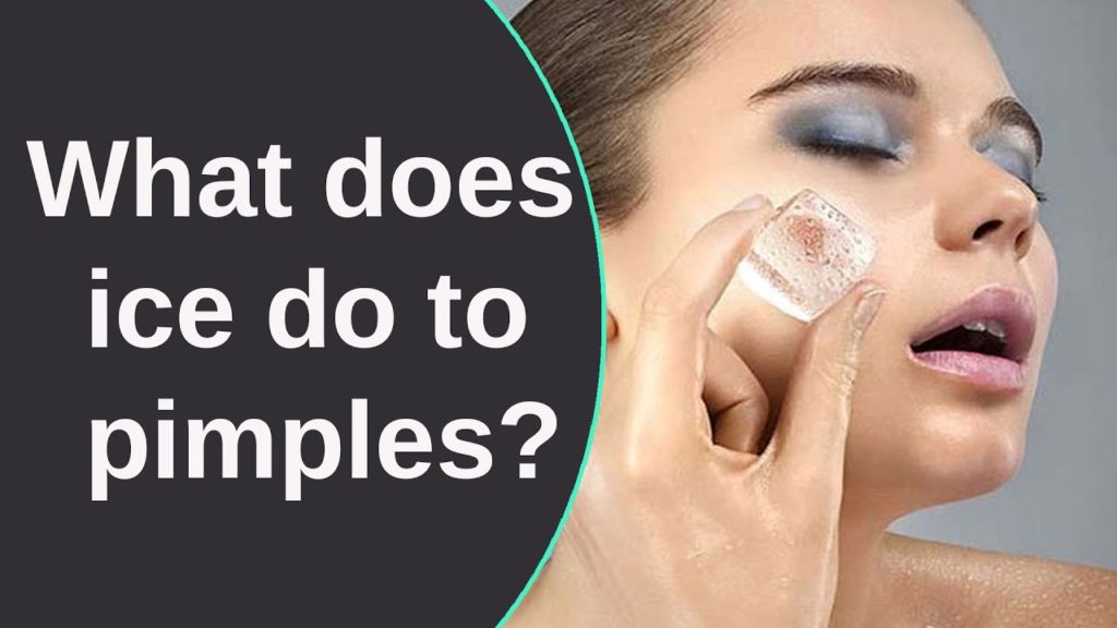 What does ice do to pimples?
