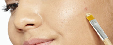 What dries up a pimple?