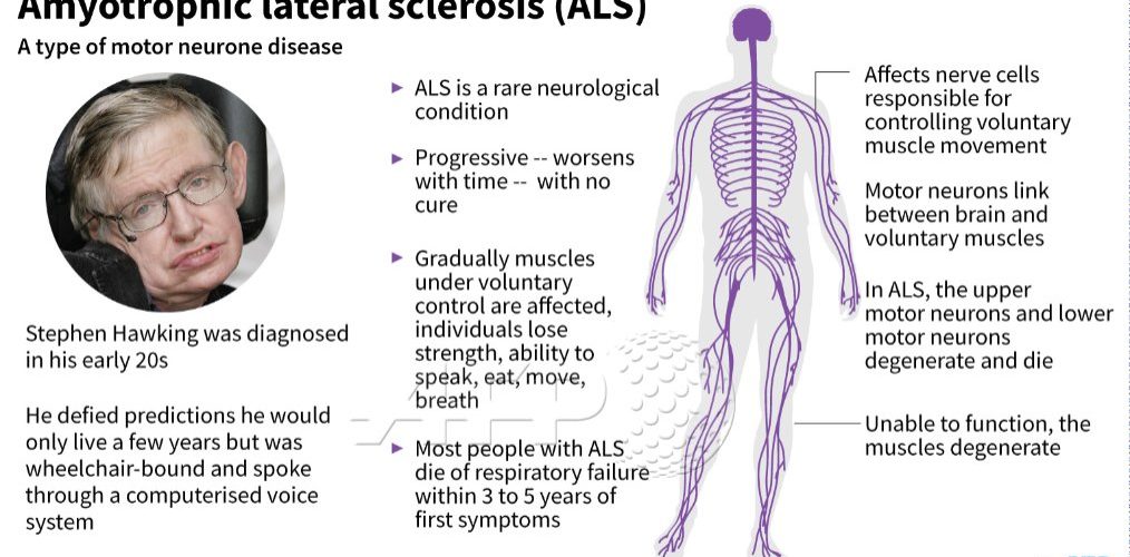 What is AXE ALS disease symptoms?