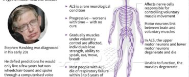 What is AXE ALS disease symptoms?